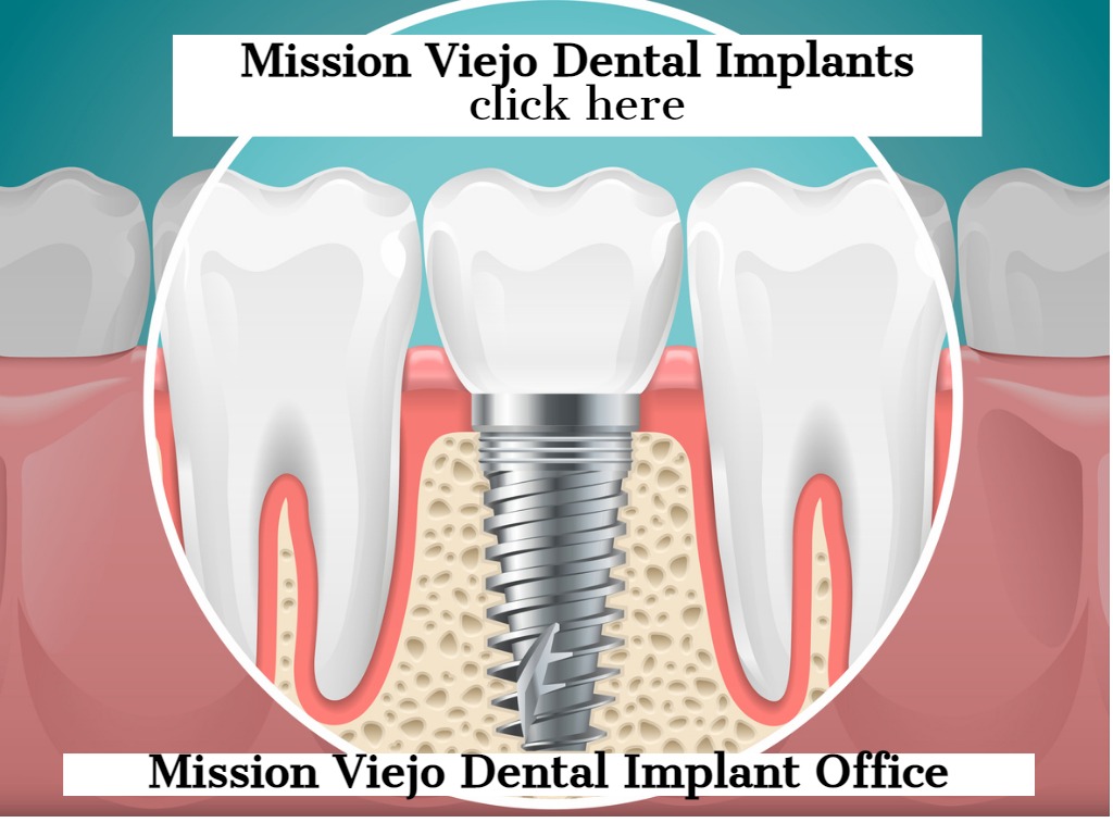 The Ultimate Guide to Dental Implants