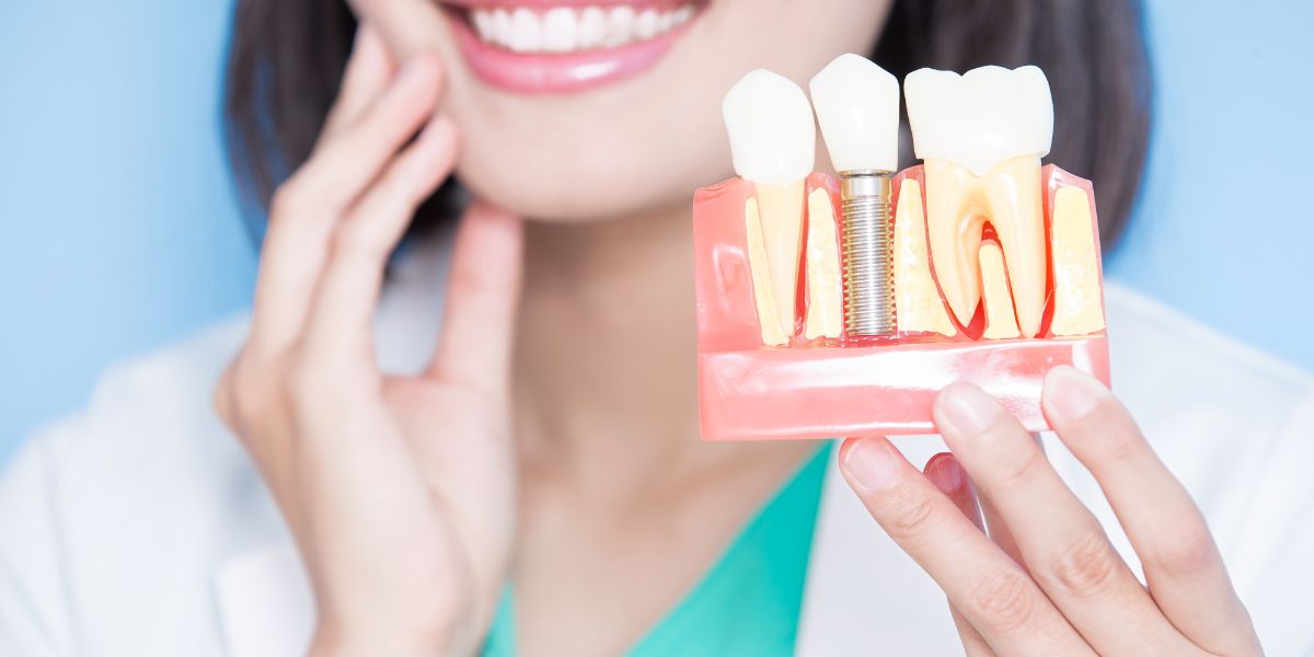 The Ultimate Guide to Dental Implants: Restoring Your Smile and Confidence